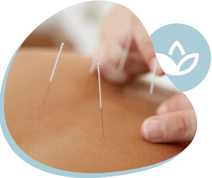 Be Well With Acupuncture